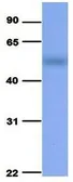 Anti-SLC37A4 antibody, Internal used in Western Blot (WB). GTX46845