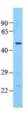 Anti-Pannexin 1 antibody, Internal used in Western Blot (WB). GTX46955
