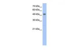 Anti-RSAD2 antibody, C-term used in Western Blot (WB). GTX46969