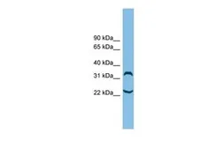 Anti-C6ORF134 antibody, N-term used in Western Blot (WB). GTX46986