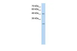 Anti-ANKRD2 antibody, N-term used in Western Blot (WB). GTX46994