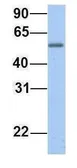 Anti-EPS8L1 antibody, Internal used in Western Blot (WB). GTX47008