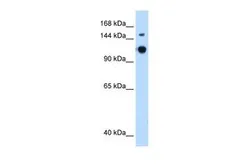 Anti-GAPVD1 antibody, N-term used in Western Blot (WB). GTX47022