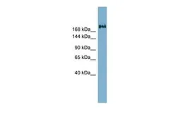 Anti-TMEM2 antibody, Internal used in Western Blot (WB). GTX47035