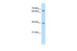 Anti-PPP2R3B antibody, C-term used in Western Blot (WB). GTX47037