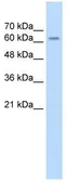 Anti-SARDH antibody, Internal used in Western Blot (WB). GTX47043
