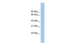 Anti-ABCB6 antibody, Internal used in Western Blot (WB). GTX47055