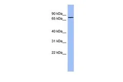 Anti-Fibulin 1 antibody, N-term used in Western Blot (WB). GTX47091