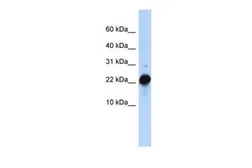 Anti-CSHL1 antibody, C-term used in Western Blot (WB). GTX47094
