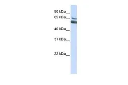 Anti-ALOX15B antibody, N-term used in Western Blot (WB). GTX47101