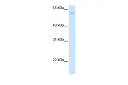 Anti-GLUT2 antibody, N-term used in Western Blot (WB). GTX47126