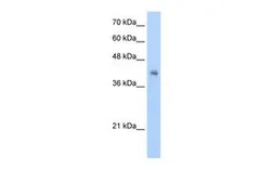Anti-VSIG4 antibody, N-term used in Western Blot (WB). GTX47141