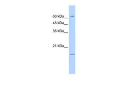 Anti-SLC13A3 antibody, N-term used in Western Blot (WB). GTX47156
