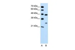 Anti-Claudin 18 antibody, C-term used in Western Blot (WB). GTX47158