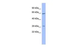 Anti-HRG antibody, Internal used in Western Blot (WB). GTX47165