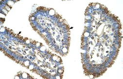 Anti-DIS3L2 antibody, N-term used in IHC (Paraffin sections) (IHC-P). GTX47207