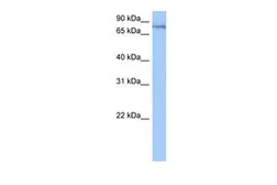 Anti-TTC14 antibody, N-term used in Western Blot (WB). GTX47222