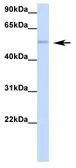 Anti-RBM47 antibody, Internal used in Western Blot (WB). GTX47272