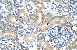 Anti-RBM38 antibody, N-term used in IHC (Paraffin sections) (IHC-P). GTX47297