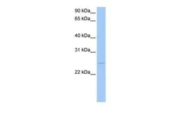 Anti-CTA-126B4.3 antibody, N-term used in Western Blot (WB). GTX47308