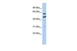 Anti-CNOT6 antibody, N-term used in Western Blot (WB). GTX47309