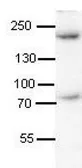 Anti-Synaptojanin 1 antibody, N-term used in Western Blot (WB). GTX47370