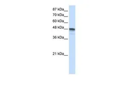 Anti-RBMS3 antibody, N-term used in Western Blot (WB). GTX47422