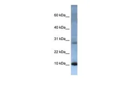 Anti-ATP5G2 antibody, N-term used in Western Blot (WB). GTX47425