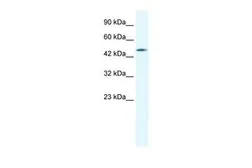 Anti-Connexin 40.1 antibody, C-term used in Western Blot (WB). GTX47476