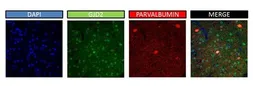 Anti-Connexin 36 antibody, Internal used in Immunohistochemistry (IHC). GTX47483