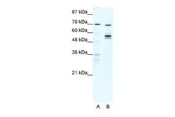 Anti-DDX55 antibody, N-term used in Western Blot (WB). GTX47504