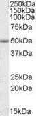 Anti-EVL antibody, Internal used in Western Blot (WB). GTX47560