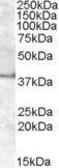 Anti-Apolipoprotein L6 antibody, Internal (near N-term) used in Western Blot (WB). GTX47586