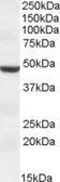 Anti-TMPRSS4 (aa245-57) antibody, Internal used in Western Blot (WB). GTX47593