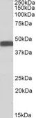 Anti-Beta Arrestin 2 antibody, Internal used in Western Blot (WB). GTX47600