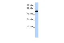 Anti-BTBD10 antibody, N-term used in Western Blot (WB). GTX47644