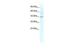Anti-KCTD10 antibody, N-term used in Western Blot (WB). GTX47648