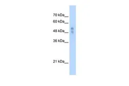 Anti-P2X1 antibody, Internal used in Western Blot (WB). GTX47691