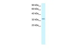 Anti-Claudin 16 antibody, C-term used in Western Blot (WB). GTX47762