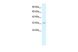 Anti-Claudin 10 antibody, C-term used in Western Blot (WB). GTX47765