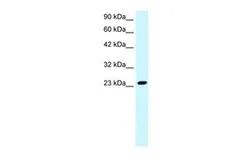 Anti-FLJ11730 antibody, N-term used in Western Blot (WB). GTX47769