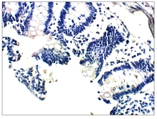 Anti-Vitamin K epoxide reductase antibody used in IHC (Paraffin sections) (IHC-P). GTX47837