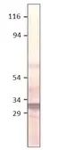 Anti-Aquaporin 11 antibody used in Western Blot (WB). GTX47927