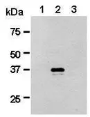 Anti-Renilla Luciferase antibody used in Western Blot (WB). GTX47953