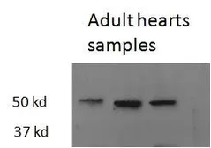 Anti-Thrb antibody, Internal used in Western Blot (WB). GTX48511