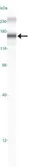 Anti-DNMT1 antibody [60B1220.1] used in Western Blot (WB). GTX48548