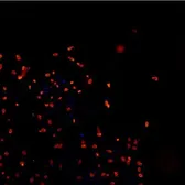 Anti-TDP43 antibody (DyLight 550) used in Immunocytochemistry/ Immunofluorescence (ICC/IF). GTX48595