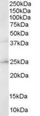 Anti-ERAB antibody used in Western Blot (WB). GTX48613
