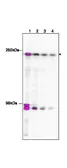 Anti-TAF1 antibody used in ChIP assay (ChIP assay). GTX48659