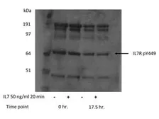 Anti-IL7 Receptor alpha (phospho Tyr449) antibody used in Western Blot (WB). GTX48714